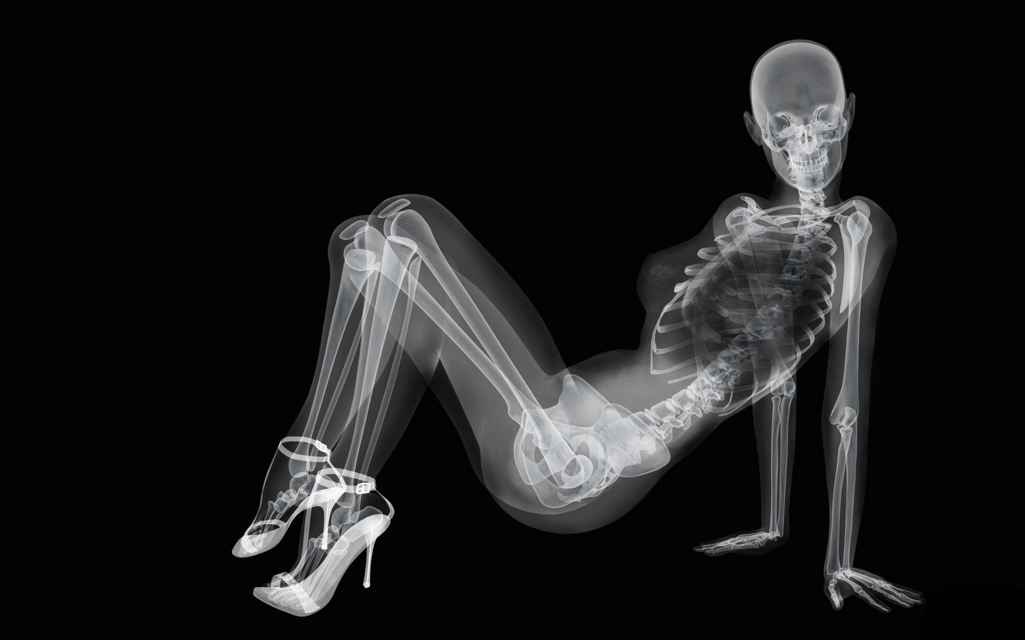 devushka-skelet-rentgen-chernyy.jpg